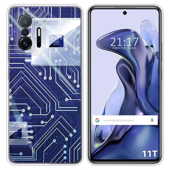 Pellicola In Idrogel Flessibile Per Xiaomi 11T E 11T Pro 5G – Protezione Totale