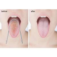 1Pcs Limpia Lengua De Acero Inoxidable U-formado Herramienta De Higiene Oral Limpieza Frescura Aliento Cepillo De Lengua - details 9