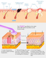 Máquina De Facial High Frequency DARSONVAL Con Argón Luz Violeta Morada Eliminador De Acné Y Masajeador Para Cuidado De La Piel Belleza - details 2
