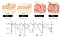 Dispositivo De Terapia Electrolítica De Alta Frecuencia Y Microcorriente Portátil Para Eliminación De Acné Y Belleza - details 2