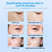 Nueva MINI Facial RF De Beemyi Instrumento De Belleza Con Corriente EMS Rejuvenecimiento De Piel Elevación Y Tensión Herramienta De Cuidado De La Piel Tamaño 13.5*18*21CM - details 12