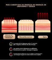 Máscara Facial LED De Terapia De Luz Roja Anti-acné Y Eliminación De Arrugas Rejuvenecimiento De La Piel Blanqueamiento Dispositivo De Belleza Del Rostro Con Carga USB - details 6