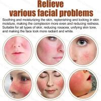 Crema de día correctora antienrojecimiento Facial, crema para el cuidado de la piel sensible a la picazón, crema hidratante para iluminar la Base, cosméticos - details 5