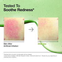 Anua Azelaica Acid Reducer Serum, facial sensible que contiene ácido hialurónico y niacina, piel coreana vegetariana natural - details 2