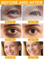 Crema de colágeno para ojos, elimina las bolsas de los ojos, antiojeras, hinchazón, Reduce las arrugas, humectante reafirmante, belleza, producto para el cuidado de la piel - details 7