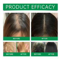 El aceite esencial de romero HOEGOA nutre, fortalece, hidrata e humecta el cabello. - details 8