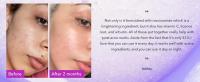 Good Molecules Tónico facial iluminador de niacinamida con niacinamida, vitamina C y arbutina tono uniforme, poros agrandados - Cuidado de la piel - details 1