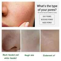Crema Reductora de Poros Adiós a los Poros Grandes Gel Reparador de Acné Suavización de la Piel - details 7