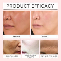 Ácido hialurónico hidratante reafirmante aclaramiento líneas finas esencia para el rostro de piel suave - details 11