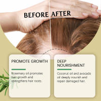 Romero de West&Montreal para hidratar el cabello, aceite esencial suave y nutritivo para el cuidado del cabello - details 4