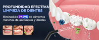 Mornwell-irrigador Oral portátil F18, hilo Dental recargable por USB, 4 boquillas, chorro de agua Dental, tanque de agua de 200ml, resistente al agua - details 2