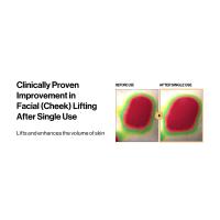 Facial Lifting