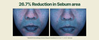 moisture serum