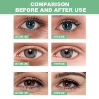 60 unidades de mascarilla de colágeno para ojos de Aloe Vera para reducir las ojeras y las bolsas de los ojos, parche hidratante para los ojos, productos para el cuidado de la piel - details 1