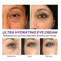Crema de Ojos de Retinol Eliminación Inmediata de Ojeras Desvanecimiento de Líneas Finas - details 10