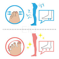 Plantillas ortopédicas Hallux Valgus para juanetes, almohadillas para juanetes para separar todos los dedos del pie, Corrector de hueso grande, almohadilla separadora - details 18