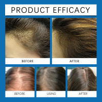 HOEGOA Essence Loción para el cuidado del cabello suavizante e hidratante suave y iluminadora - details 11
