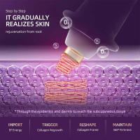 RF radiofrecuencia estiramiento facial EMS mesoterapia microcorriente estiramiento antiarrugas rejuvenecimiento de la piel belleza pluma de oxígeno - details 5