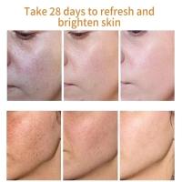 Crema Facial para iluminar y nutrir la piel Niacinamida para reducir manchas oscuras - details 1