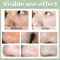 Té verde Original, elimina profundamente los puntos negros, mascarilla de barro para acné, palo, reduce los poros, disipa la crema para el acné, trata las espinillas, cuidado coreano de la piel limpia - details 8