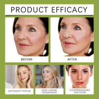 HOYGI Retinol Moisturizing es una esencia hidratante suave que puede hidratar y proteger la piel del rostro. - details 6