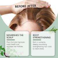 Spray nutritivo para el crecimiento del cabello denso y oscuro, masaje nutritivo del cuero cabelludo con romero - details 5
