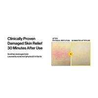 Damaged Skin Relief 2