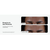 Paula's Choice SKIN PERFECTING 2% BHA Exfoliante líquido de ácido salicílico-exfoliante facial para puntos negros, poros agrandados y arrugas - details 5