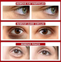 Suero para ojos para eliminación de gránulos de grasa, antiojeras, bolsas para ojos, se desvanecen, esencia de línea fina, antihinchazón, productos hidratantes para el cuidado de la piel - details 8
