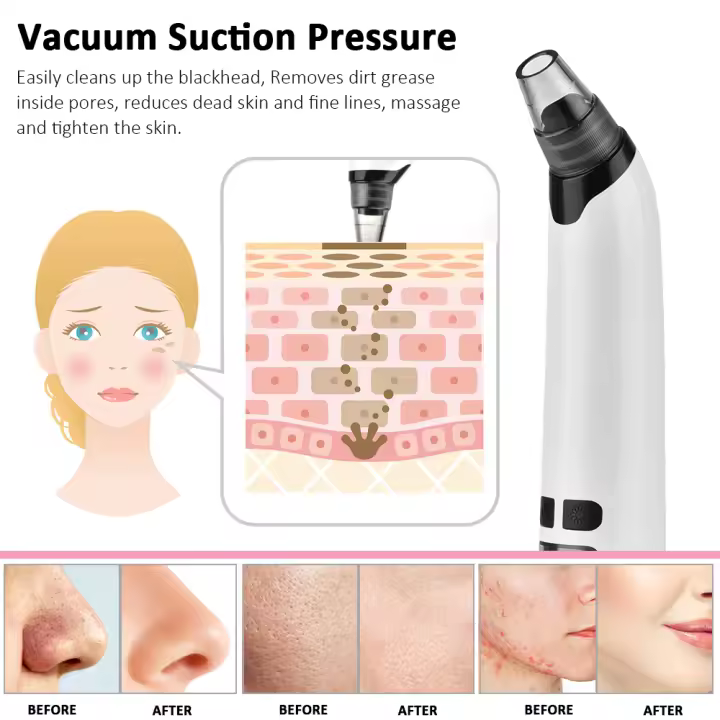 Eliminador de Espinillas Eléctrico Negro Limpieza Facial Agua Ciclo Succión Pore Acné Limpiador Punto Negro Eliminación Exfoliantes para Piel Normal - 1