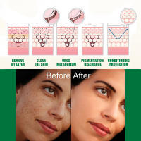 Suero Blanqueador Corrector de Manchas Dark Spots Iluminador de Piel Cuidado de Belleza Coreano - details 6