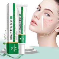 Herbal Acne Treatment Cream Face Scar Blackhead Remover Repair Gel Oil Control Shrink Pores Whitening Skin Care Korean Cosmetics - details 0