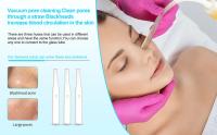 Máquina de belleza de Lifting Facial Bipolar y EMS, dispositivo 3 en 1 para estiramiento de la piel, moldeador corporal, masaje de ojos, instrumento de cuidado de la piel, novedad - details 15