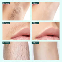 Máquina de depilación corporal para mujeres, afeitadora de axila, área íntima, recortadora de vello de piernas, depiladora, cuchilla tres en uno, axilas, maquinilla de afeitar, Bikini - details 8