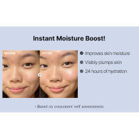 Thehyaluronic_c0
