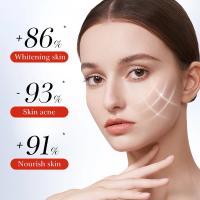 Crema para eliminar manchas blanqueadoras de Ácido Kójico, elimina el melasma, corrección de melanina, mejora la piel, aclara las manchas oscuras, cosméticos - details 5