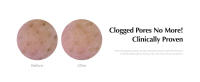 Pore Cleansing