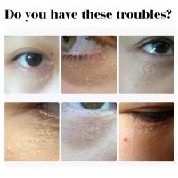 Crema para ojos eliminadora de gránulos de grasa, crema firme antiinflamatoria, Reduce las ojeras, desvanece las líneas finas, barrera de reparación Sk - details 4