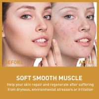 Esencia Facial de Ácido Hialurónico Piel Suave y Luminosa con Rice Pulp Anti-arrugas, Blanqueador - details 9