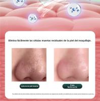 Limpiador de Piel Ultrasónico Aclarado de Poros, Levantamiento y Enderezo - details 15