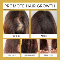 Aceite para el cuidado del cabello con extracto de plantas que nutre el cuero cabelludo, suaviza, brilla y suaviza. - details 11