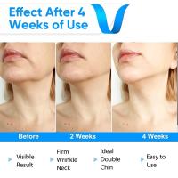 Masajeador Facial EMS Antiarrugas Con Corriente Microcorriente RF Máquina De Belleza Para El Cuello Y Rostro Elevación Y Tensión De La Piel Cuidado De La Piel - details 5