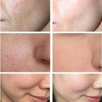 Crema Blanqueadora Sakura Serum Removedor de Arrugas Esencia Reafirmante - details 2