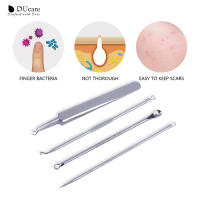 Herramientas de Maquillaje DUcare 4PCS Extractor de Acné y Espinillas de Acero Inoxidable Limpiador de Piel Facial para Todo Tipo de Piel - details 5
