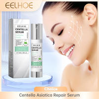 Esencia Facial de Centella Asiatica, suero Facial hidratante que ilumina el cuidado de la piel suave, rejuvenecimiento, refinamiento de poros, rejuvenecimiento - details 2