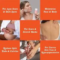 Aceite Esencial para Cuidado de la Piel de Cuerpo 2PCS Mejora la Piel Desigual y Marcas de Elástico - details 8