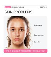 Sakura-Gel exfoliante para el rostro, exfoliante hidratante, reparación nutritiva, crema Facial, belleza, cuidado de la piel - details 1