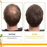 La biotina hidrata profundamente y mejora el cuidado del cuero cabelludo, suaviza el aceite esencial para el cuidado del cabello. - details 9