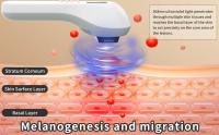 Lámpara de Terapia UVB KTS para Tratamiento de Vitiligo 308NM Luz Ultravioleta de Banda Estrecha para Eczema y Psoriasis Herramienta de Cuidado de la Piel Corporal - details 2