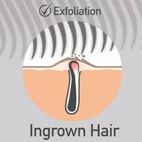Dylonic Ingrown Hair Brush Treatment Exfoliating brush